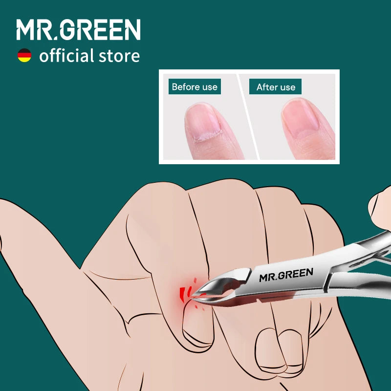 MR.GREEN Cuticle Nippers Nail Clippers Stainless Steel Manicure Tool