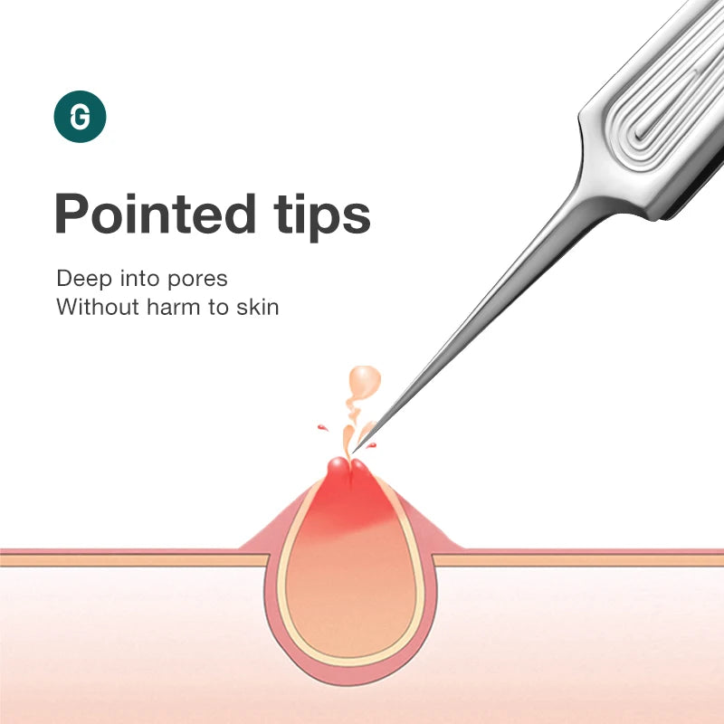 MR.GREEN Ingrown Hair Tweezers With Needle Nose Pointed Tips