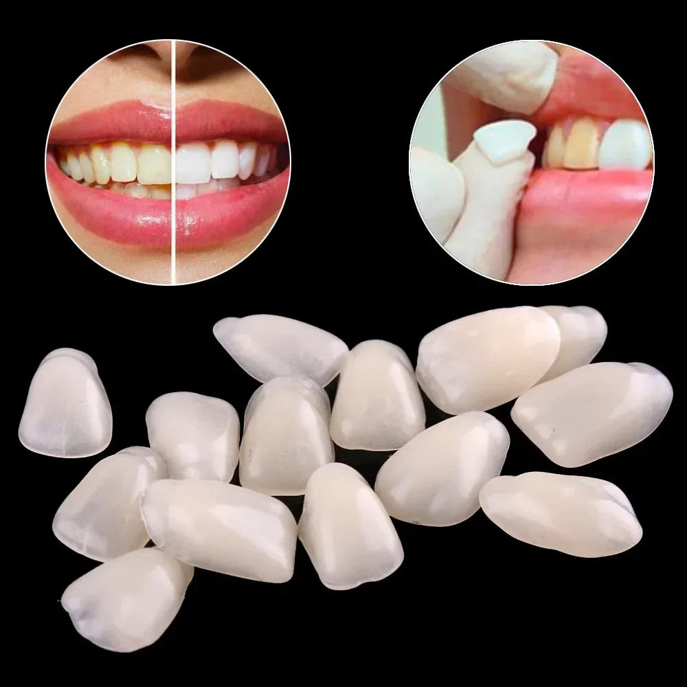 Ultra Thin Whitening Porcelain Veneers Temporary Crowns