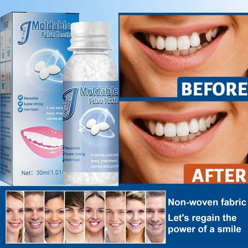 Temporary Tooth Repair Beads For Dentures Resin Adhesive