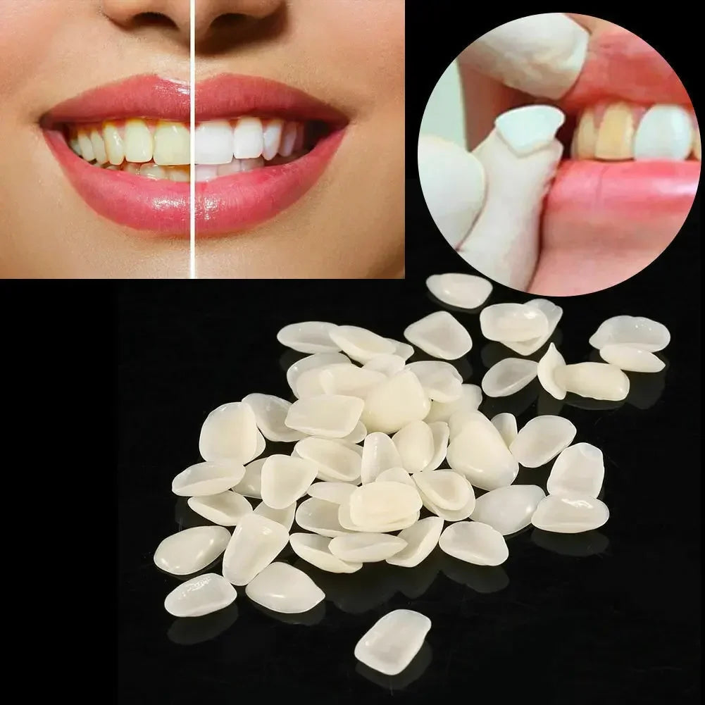 Ultra Thin Whitening Porcelain Veneers Temporary Crowns