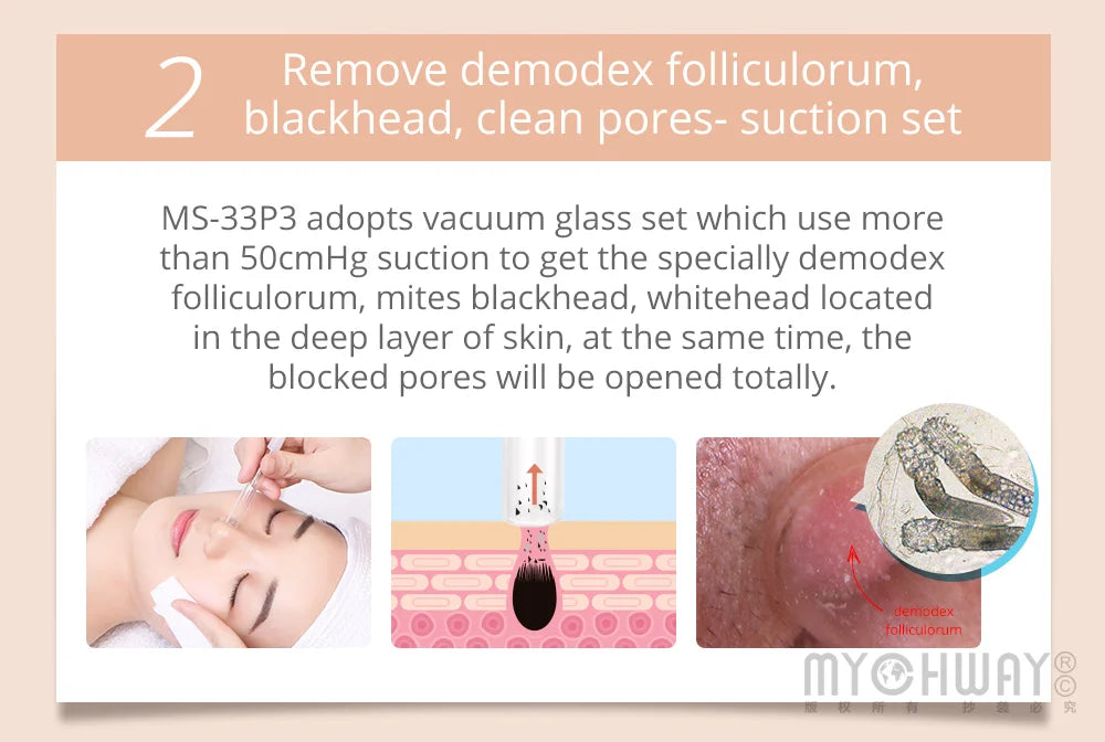 Mychway 3 In 1 Ultrasound Dermabrasion Facial Cleaning Device